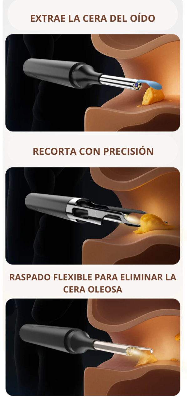 Kit de limpieza de oídos HD de 10 MP con pinzas de precisión y cuchara de silicona